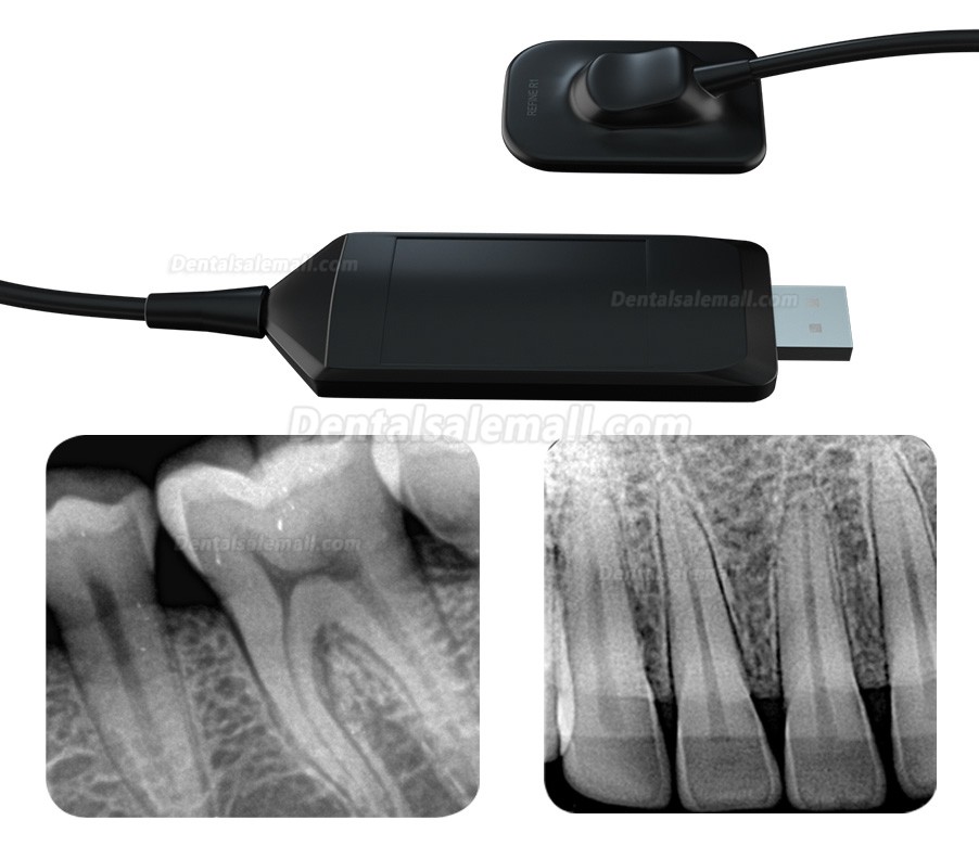Refine VeRay Portable Dental X-Ray Unit + Dental X-ray Intraoral Sensor Kit